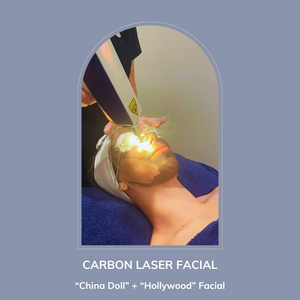 Carbon Laser Facial