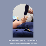 Load image into Gallery viewer, IPL Pigmentation Removal
