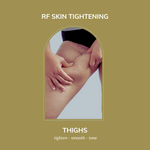 Load image into Gallery viewer, Thighs - RF Skin Tightening
