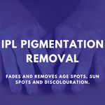 Load image into Gallery viewer, IPL Pigmentation Removal
