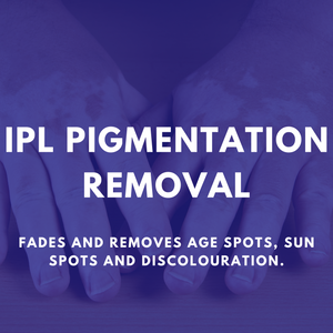IPL Pigmentation Removal