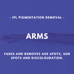 Load image into Gallery viewer, IPL Pigmentation Removal
