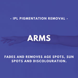 IPL Pigmentation Removal