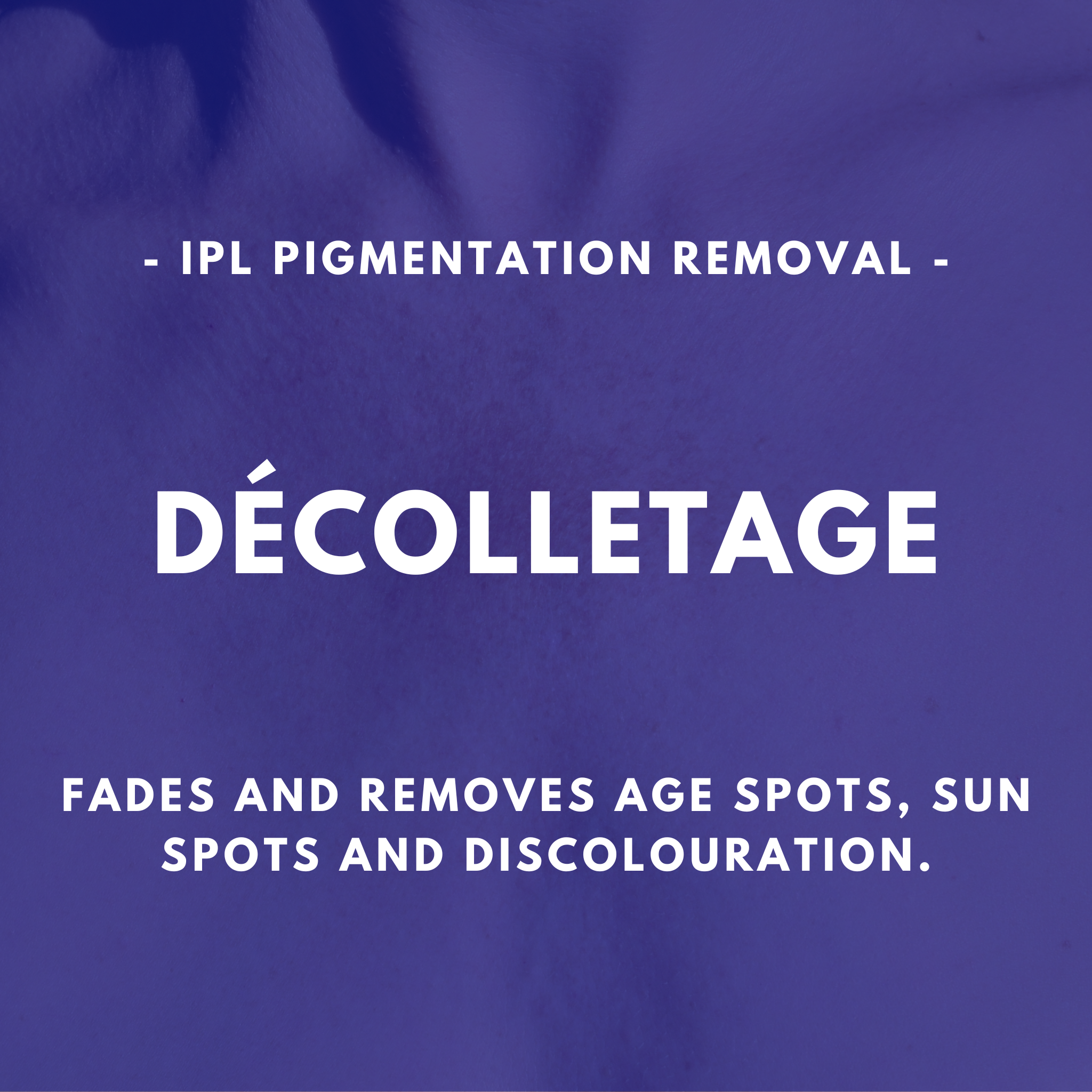 IPL Pigmentation Removal