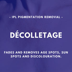 IPL Pigmentation Removal