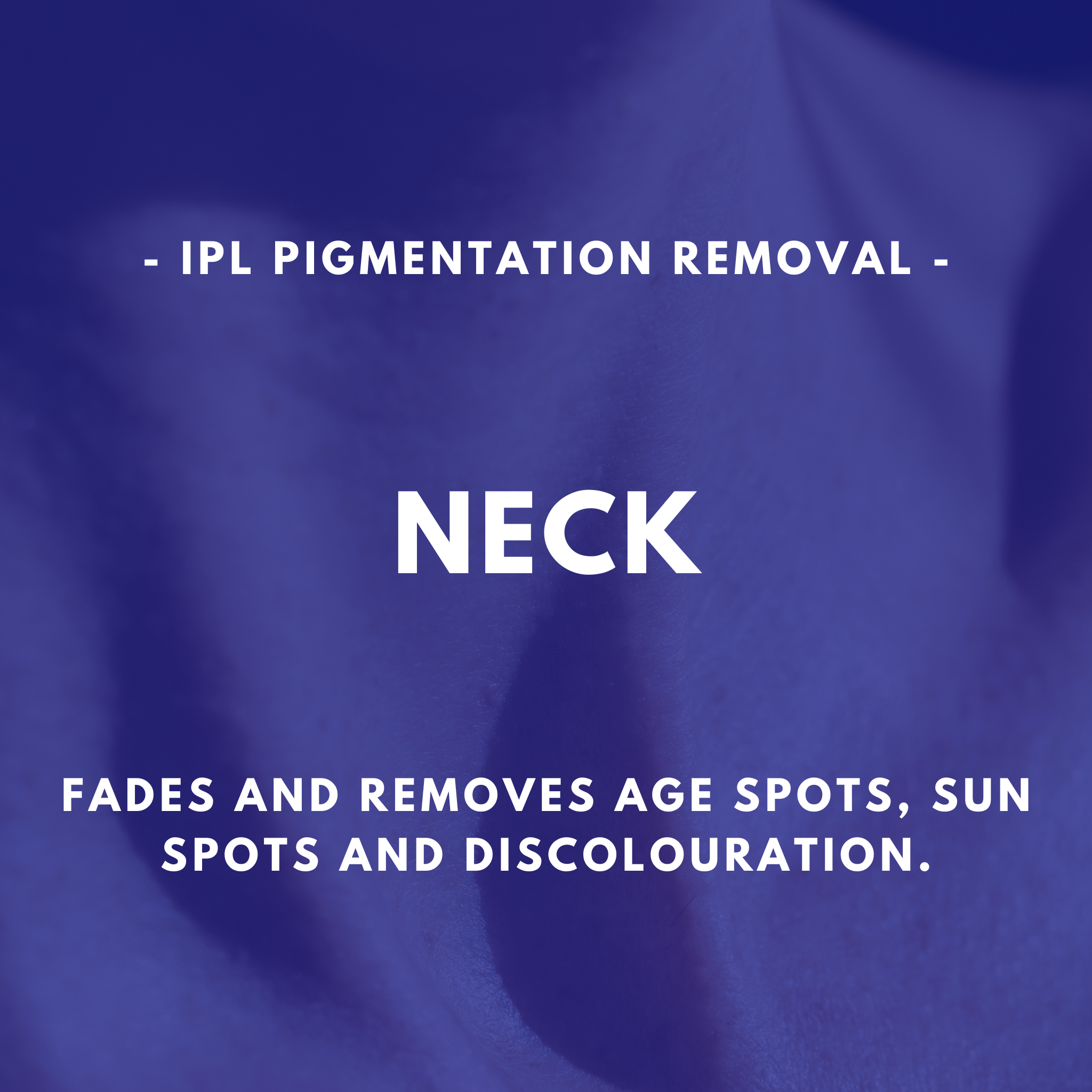 IPL Pigmentation Removal