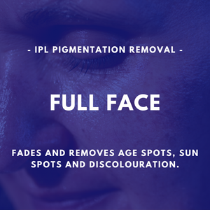 IPL Pigmentation Removal