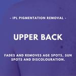 Load image into Gallery viewer, IPL Pigmentation Removal
