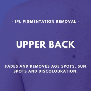 IPL Pigmentation Removal