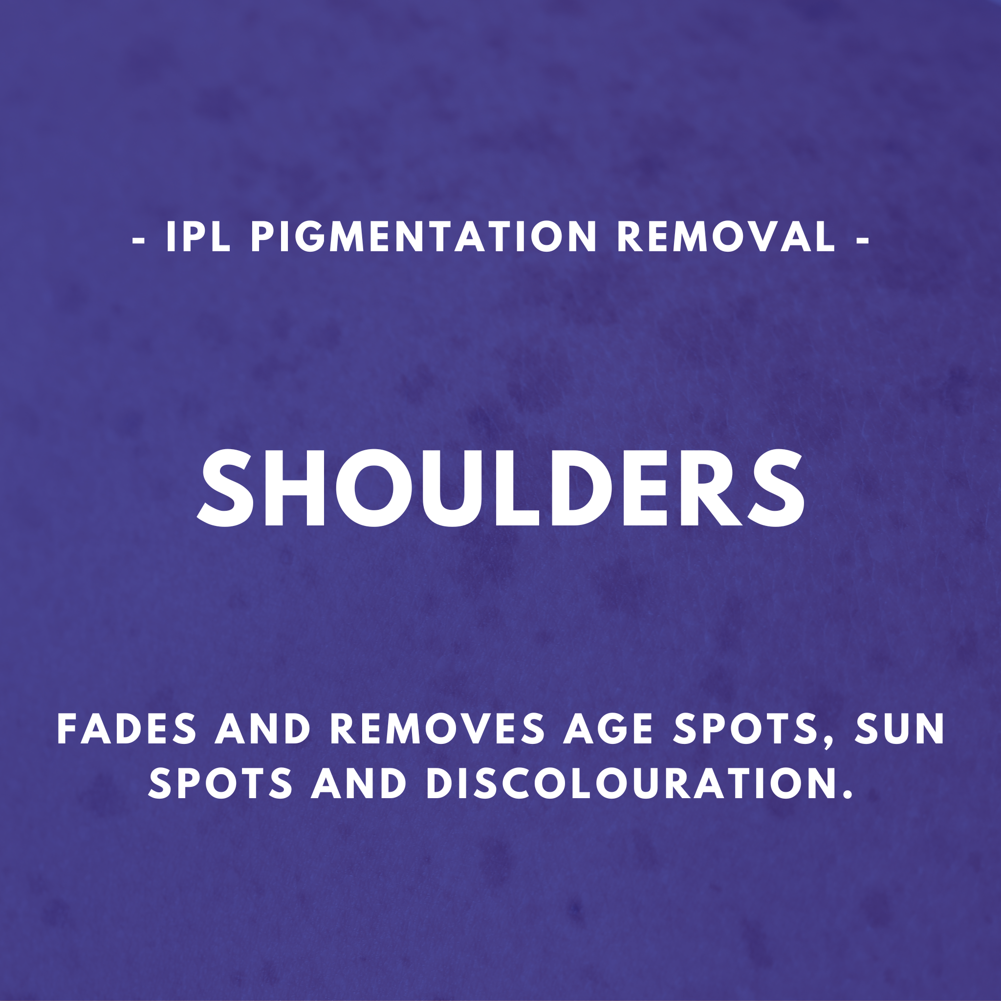 IPL Pigmentation Removal