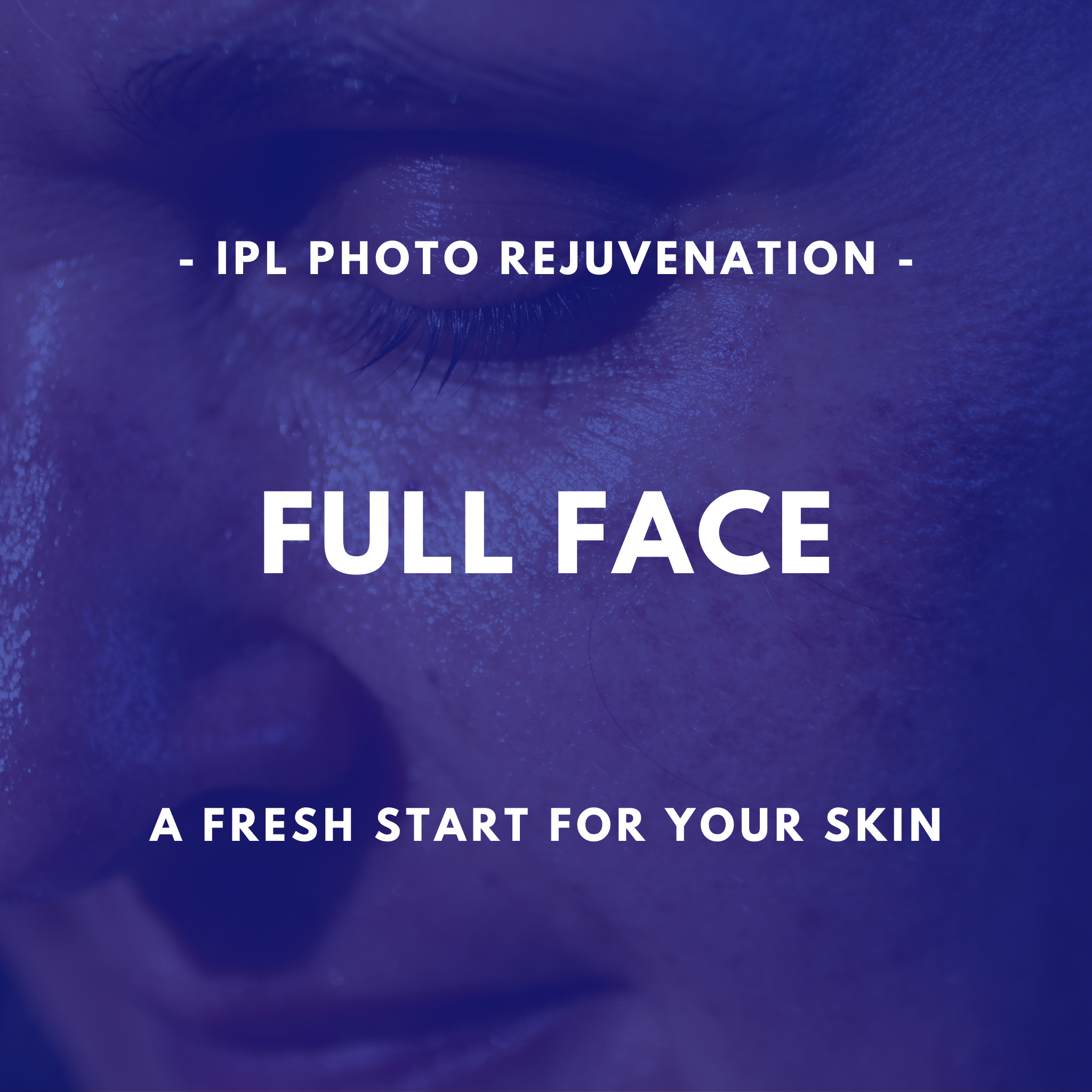 IPL Photo Rejuvenation