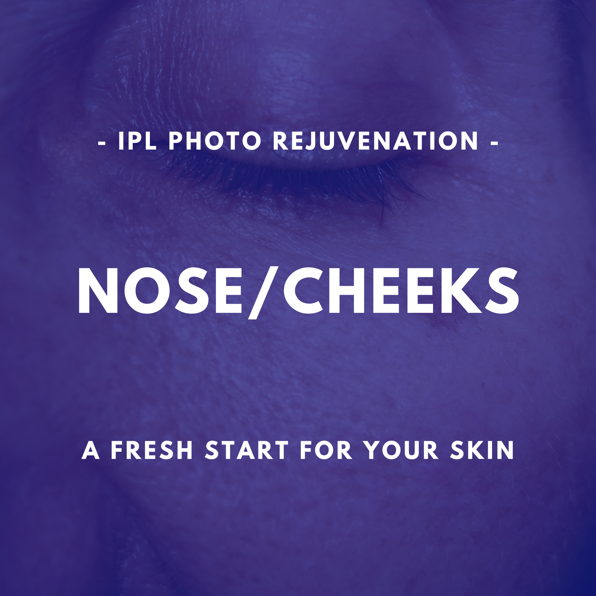 IPL Photo Rejuvenation