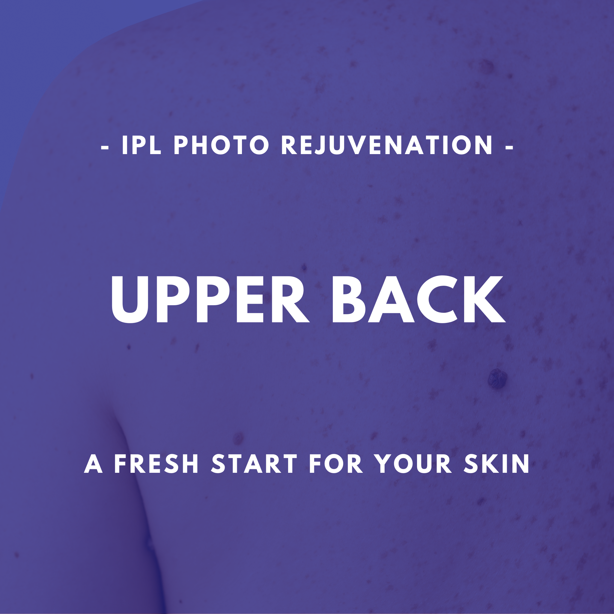 IPL Photo Rejuvenation