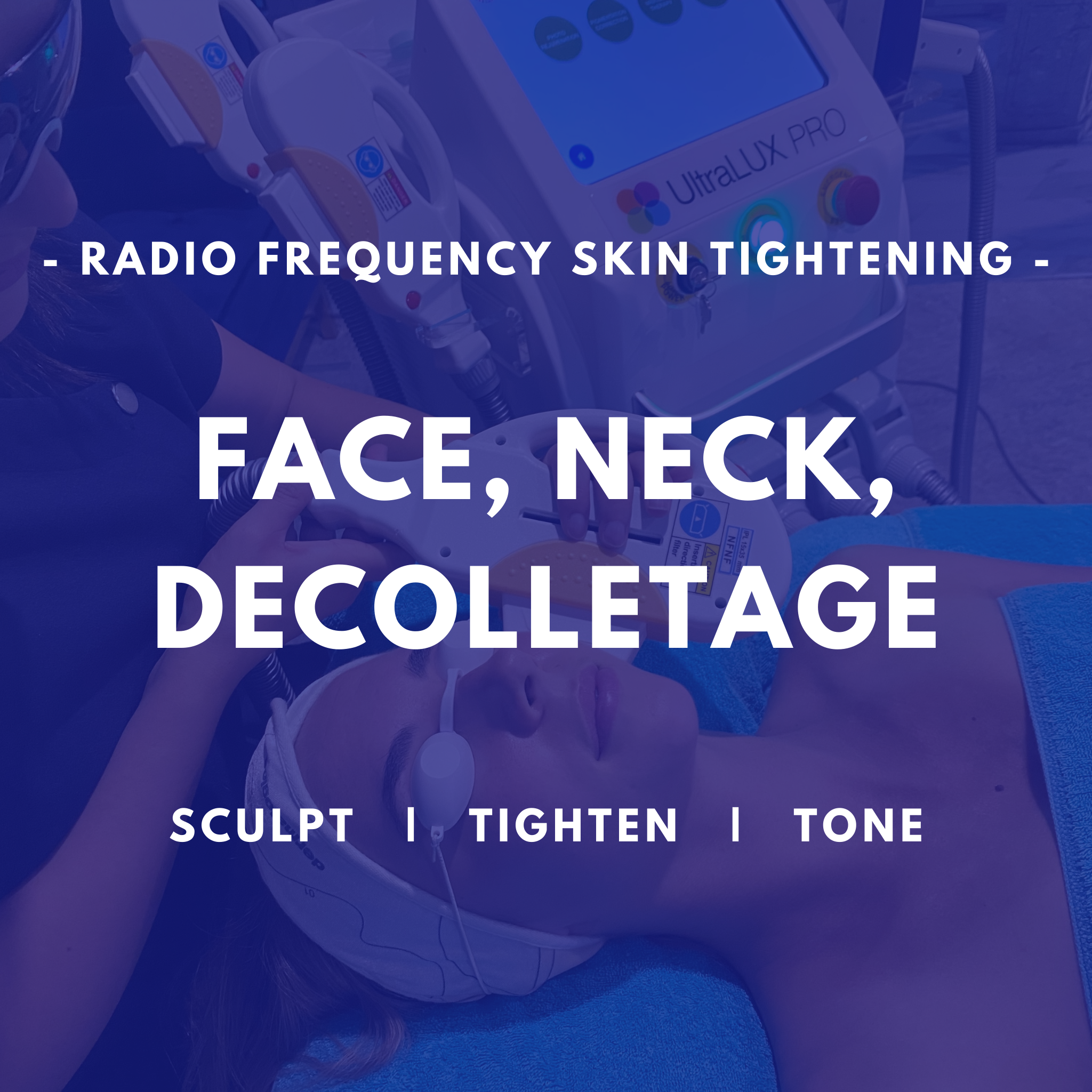 Face, Neck, Décolletage - RF Skin Tightening