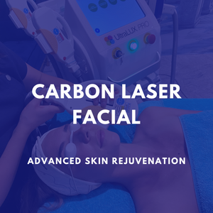 Carbon Laser Facial