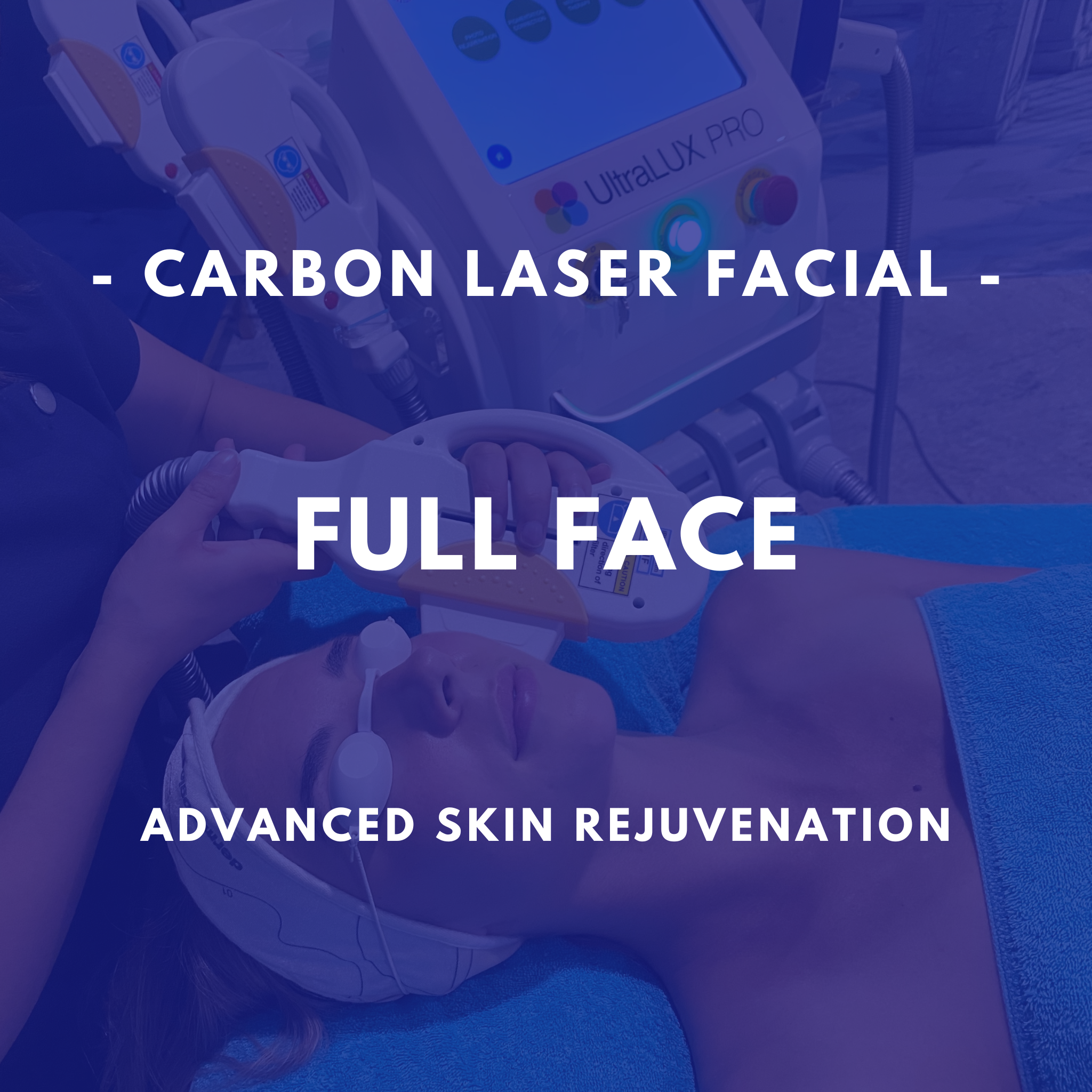 Carbon Laser Facial