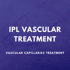 IPL Vascular Treatment